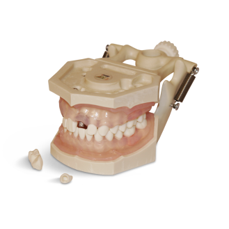 Modello anatomico gengivale E12N-Leggi tutto
