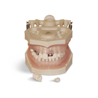 Modello anatomico gengivale E12N-Leggi tutto