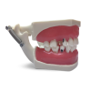 Modello anatomico gengivale E56