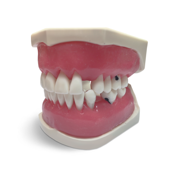 Modello anatomico gengivale E56-Leggi tutto