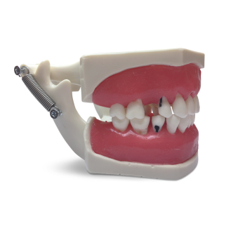 Modello anatomico gengivale E56-Leggi tutto