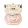Modello anatomico gengivale E11