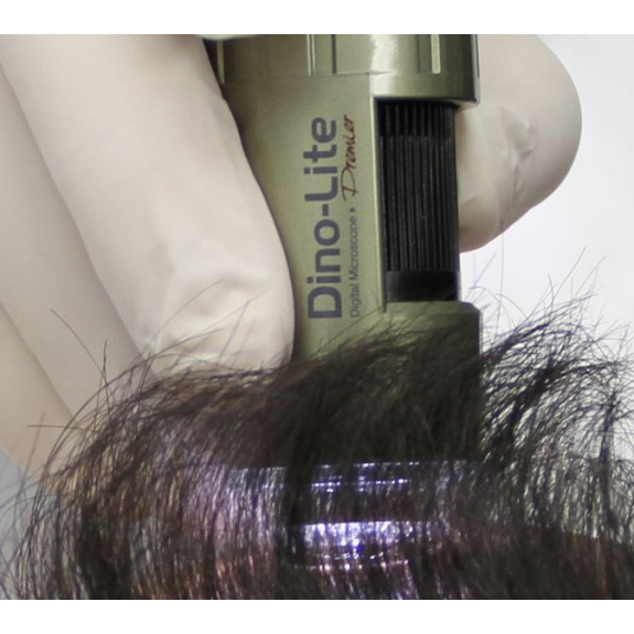 Trichoscope Polariseur Dino-Lite  MEDL4HM-Lire la description