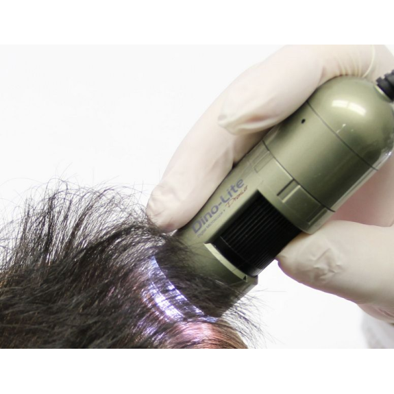 Trichoscope Polariseur Dino-Lite  MEDL4HM-Lire la description