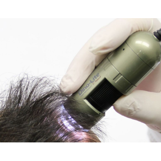 Trichoscope Polariseur Dino-Lite  MEDL4HM-Lire la description