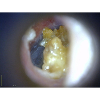 Otoscope Basique Dino-Lite  MEDL3E-Lire la description
