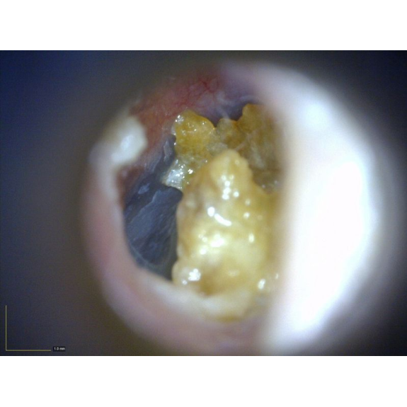 Otoscope Basique Dino-Lite  MEDL3E-Lire la description