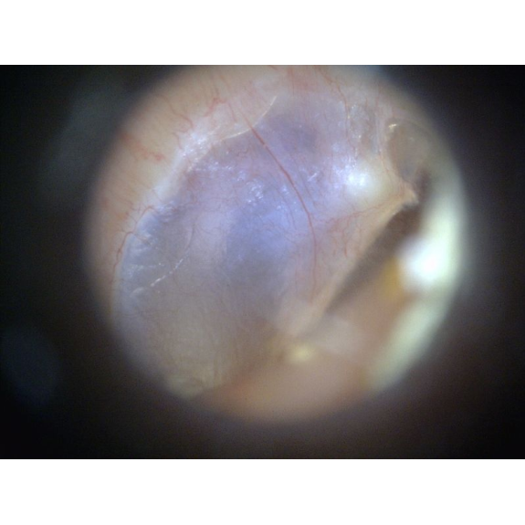Otoscope Basique Dino-Lite  MEDL3E-Lire la description
