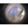 Otoscope Basique Dino-Lite  MEDL3E