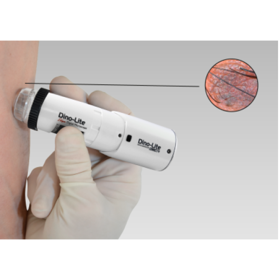 Dermatoscope Polariseur Wifi Dino-Lite MEDL4DW-Lire la description