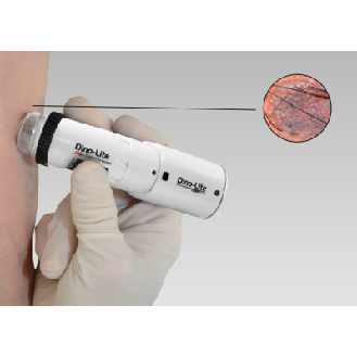 Dermatoscope Polariseur Wifi Dino-Lite MEDL4DW-Lire la description