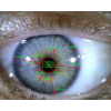 Iriscope Dino-Lite  MEDL4R