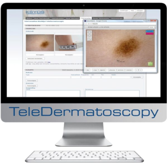 Dermatoscope Polariseur Filaire Dino-Lite  MEDL4DW-Lire la description