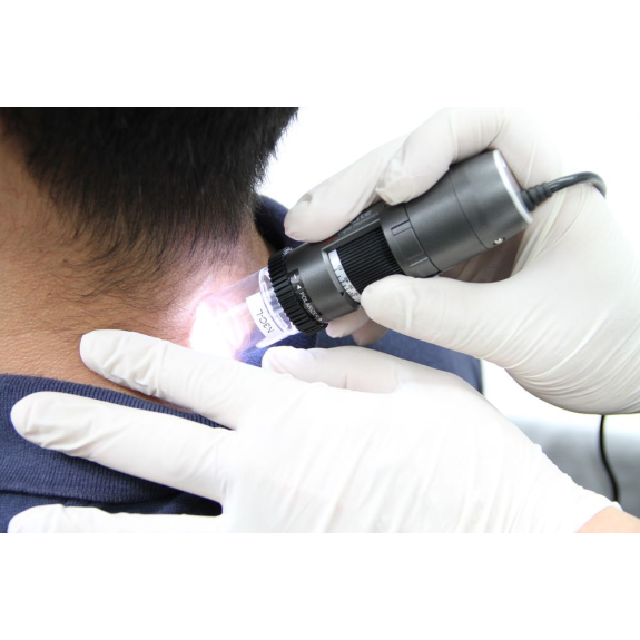 Dermatoscope Polariseur Filaire Dino-Lite  MEDL4DW-Lire la description