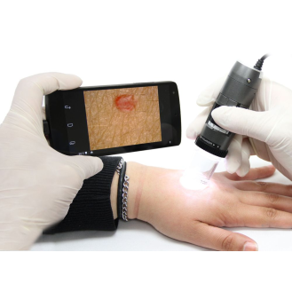 Dermatoscope Polariseur Filaire Dino-Lite  MEDL4DW-Lire la description