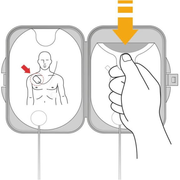 Électrodes pédiatriques défibrillateur Philips FRX-Lire la description