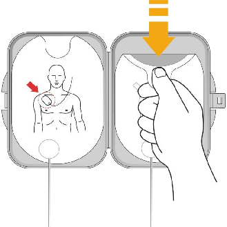 Électrodes pédiatriques défibrillateur Philips FRX-Lire la description