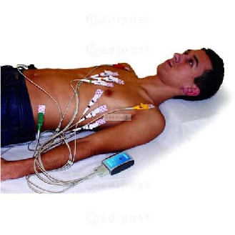 ECG numérique Eolys-Lire la description