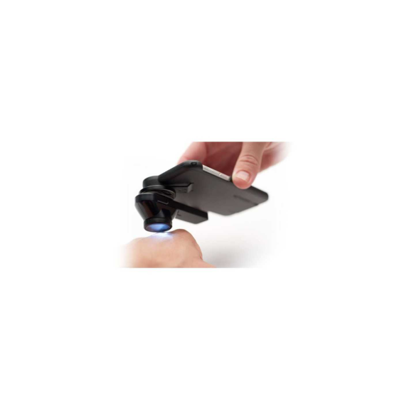 DERMATOSCOPE DERMLITE DL1 BASIC-Lire la description