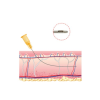 CANULA RELLENO AQULIFT NATURAL-FILL 17G X 90 MM (20 UDS)