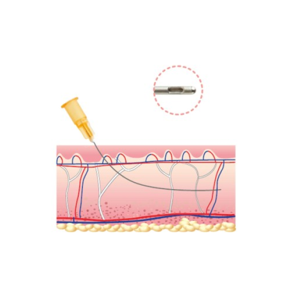 Cánula de relleno facial Aqulift Natural-Fill 26G x 50mm (20 piezas) para procedimientos cómodos y seguros Cánula de relleno facial Aqulift Natural-Fill 26G x 50mm (20 piezas) para procedimientos cómodos y seguros-Leer más