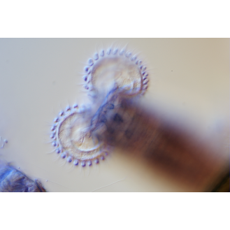 Cámara de microscopio BRESSER MikroCam II 20 MP - sensor de  1''-Leer más