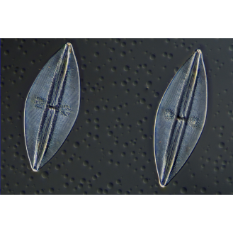 Cámara de microscopio BRESSER MikroCam II 20 MP - sensor de  1''-Leer más