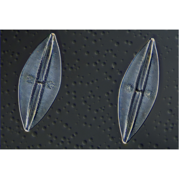 Cámara de microscopio BRESSER MikroCam II 20 MP - sensor de  1''-Leer más