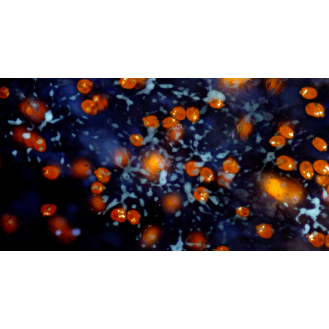 Cámara de microscopio 9MP 4K con sensor CMOS-Leer más