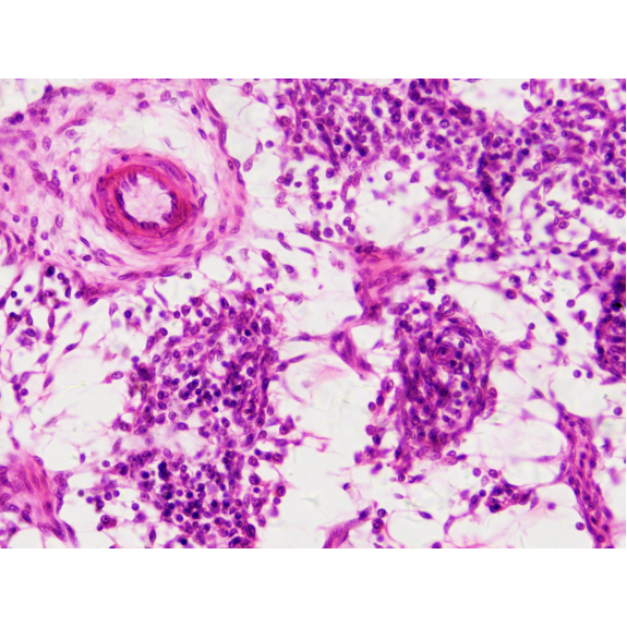 BRESSER Muestras Preparadas: Histología-Leer más