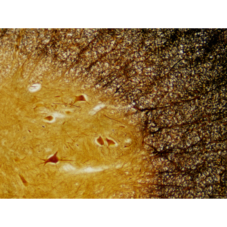 BRESSER Muestras Preparadas: Histología-Leer más