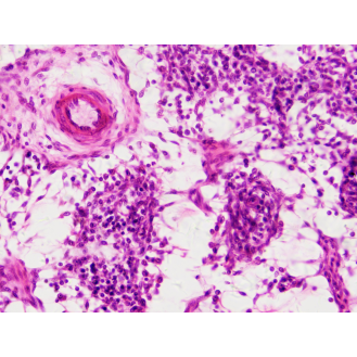 BRESSER Muestras Preparadas: Histología-Leer más