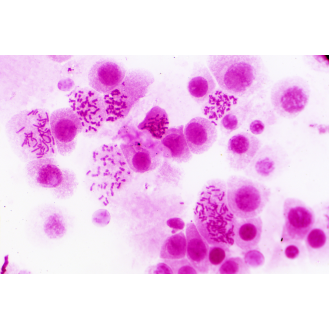 BRESSER Muestras Preparadas: Histología-Leer más